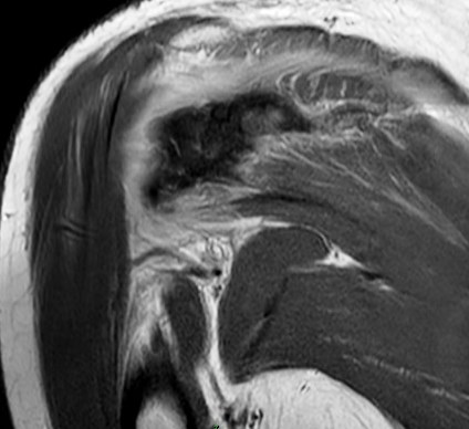 Figure 3 for case Stab wound